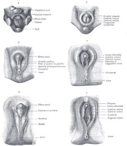 Das deutsche verfassungsgericht hat gestern entschieden, dass intersexuelle künftig beim geschlecht ganz offiziell eine dritte option wählen können. Labioscrotal swelling - Wikipedia