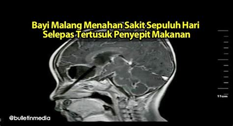 Eat, ate, food, lunch, eating, 2 eggs, flipflops, eat first, paper clip. Bayi Malang Menahan Sakit Sepuluh Hari Selepas Tertusuk ...