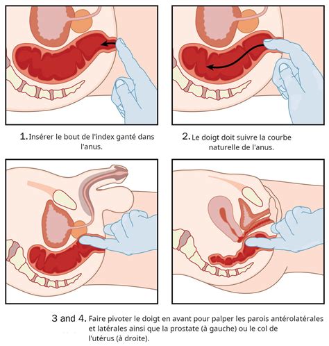 Je me marre, je suis pliée, pas de ce qui se passe aux usa mais de tous les imbéciles et de leurs délires. TR : comment faire un toucher rectal