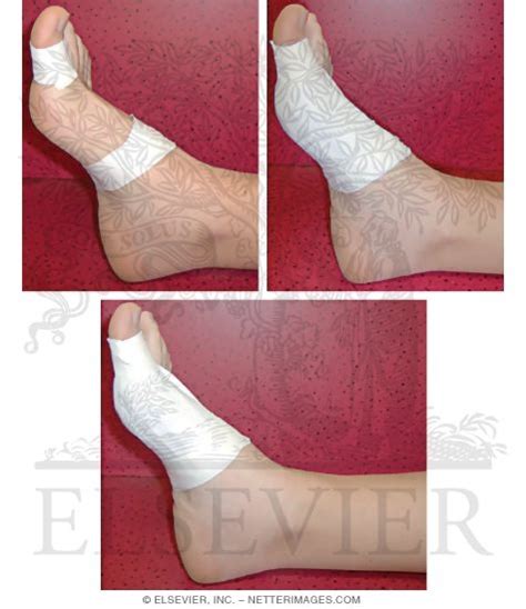 An injury like this will turf toe taping technique as taught at montclair state university. Taping Procedures: Turf-Toe Taping