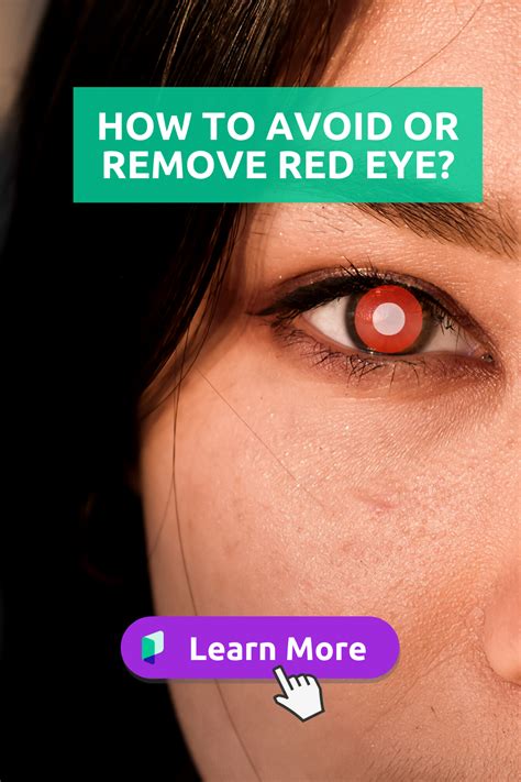 Release the mouse and the red eye correction will be applied. How to Avoid or Remove Red Eye in 2020 | How to remove ...