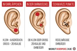 Bitte beachten sie, dass bienenprodukte bei einigen personen allergische reaktionen auslösen können. ᐅ Pickel im Ohr schnell und effektiv loswerden - Ratgeber 2021