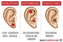 Pickel im ohr sind nicht nur lästig, sondern können auch mit schmerzen verbunden sein. ᐅ Pickel im Ohr schnell und effektiv loswerden - Ratgeber 2021