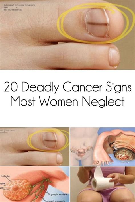 These qualities, mixed with an inherent charm and sense of humour, make them the most magnetic zodiac sign. 20 Deadly Cancer Symptoms Most Women Ignore | Healthy Next