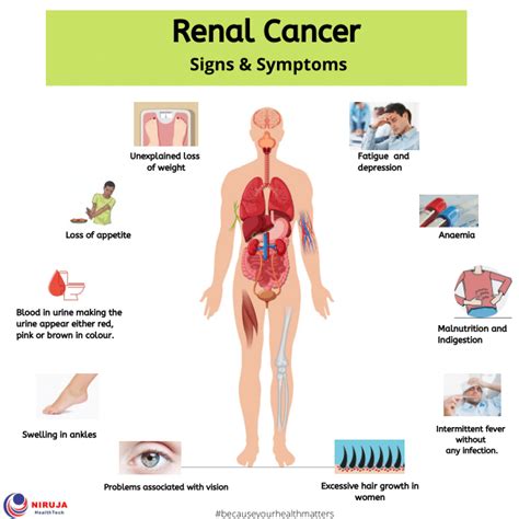 There are 7352 cancer fighters that are members here. Renal Cancer: Signs & Symptoms > Niruja HealthTech