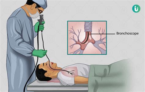 What is the meaning of throat wash? Bronchoscopy: Procedure, Purpose, Results, Cost, Price