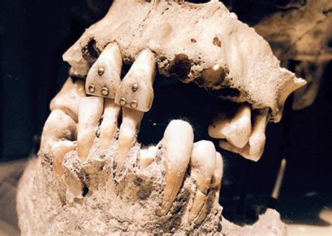 In 1924, scholars in history were roused by the announcement of sir john marshall evidence of seven fire altars and camel bones. 1,600-Year-Old Elongated Skull with Stone-Encrusted Teeth ...