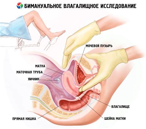 Du willst mehr über das thema männliche geschlechtsorgane lernen? Bimanuelle vaginale Untersuchung: Technik der Durchführung ...