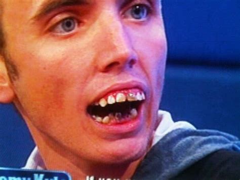 Having bad teeth is one of the stock american jokes about british people. WE NEED TO TALK ABOUT THIS....NOW! - Page 9