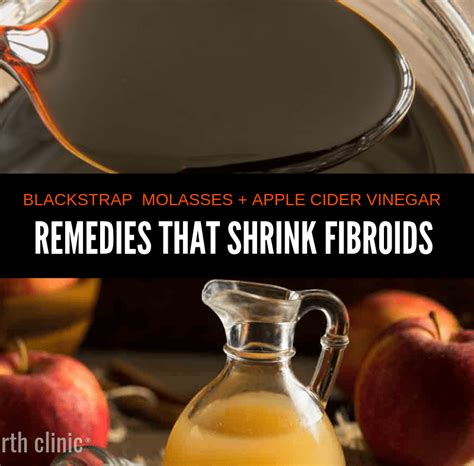 Taking small amounts of apple cider vinegar should not offer many risks, but taking. Apple Cider Vinegar + Blackstrap Molasses for Fibroids ...