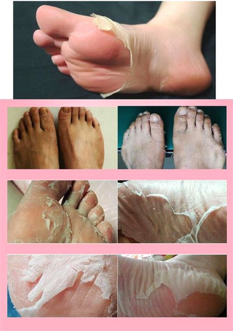This simple homemade foot spray is gentle yet healing, and uses all natural ingredients to truly heal your feet and help them smell lovely. DIY Mud Foot Mask For Detox & Smooth Skin | BoboBrid in ...