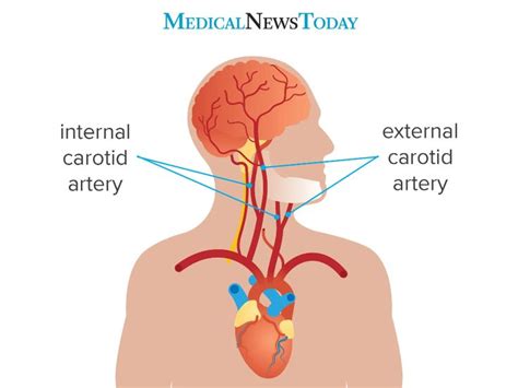 One carotid artery is located on each side of your neck. Carotid artery: Anatomy, function, disease, and more in ...