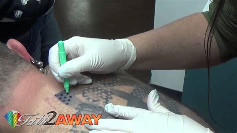 Once it's under the skin's outermost layer, it can't be rubbed off. Tatt2Away - All Natural Non-Laser Tattoo Removal - YouTube