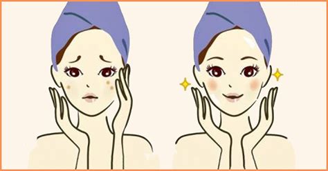 Baking soda, is the best home remedies for so many things and works like a surprise to get rid of pimples overnight. How To Get Rid Of Pimples Overnight Fast | Pimples ...