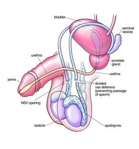 Here's my first male torso sketch. Patient Consultation Diagram