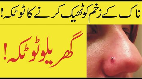 More images for how to fix an infected nose piercing » Naak Ke Zakham Ko Theek Karne Ka Tarika, ilaj aur totka ...