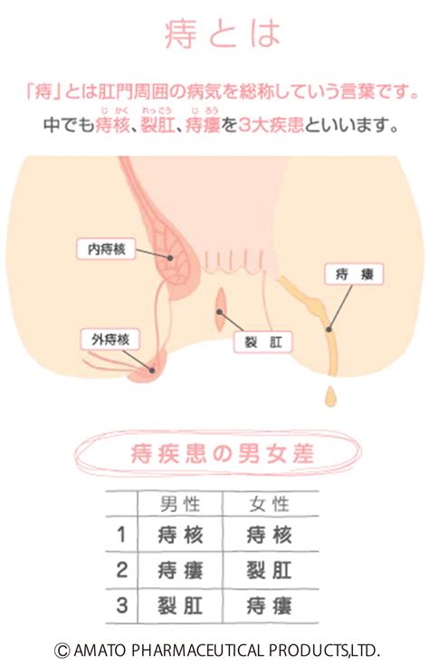 尻の穴 痒い | お尻の穴がかゆいのはなぜか、その理由と対処法 ...