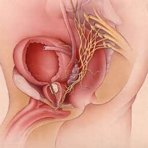 While different medical organizations have differing opinions on when and how to be screened for. Negydomas prostatos vėžys nėra mirties sinonimas. - mednews.lt