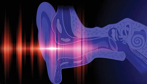 (redirected from exposure action value). Advances in Understanding Noise Exposures