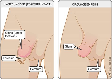Vacuuming was my favorite part of now it was dark, and sean's wife and son lay in their tent and worried. Circumcision Information for Families - Sunnybrook Hospital