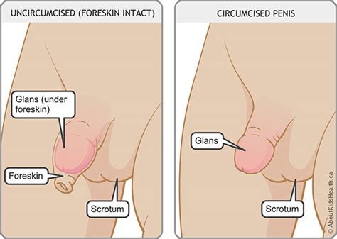 Richard mann balls deep in pussy. Circumcision Information for Families - Sunnybrook Hospital