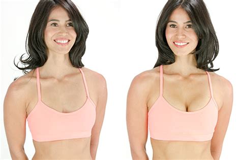 These bras are a new favourite. UpBra - Before and After Photo Gallery