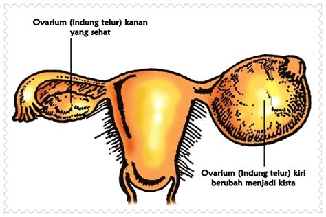 We did not find results for: Obat Alami Untuk Mengatasi Susah BAB: Obat Tradisional ...