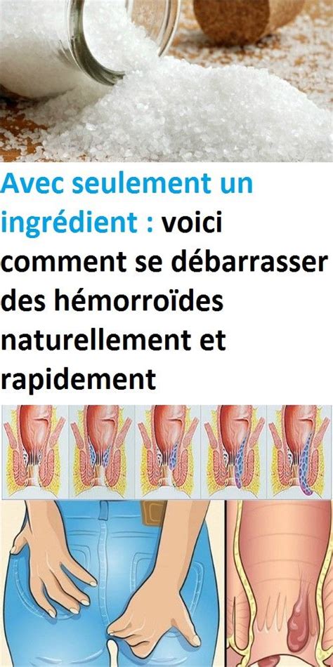 Maybe you would like to learn more about one of these? Épinglé sur remedes