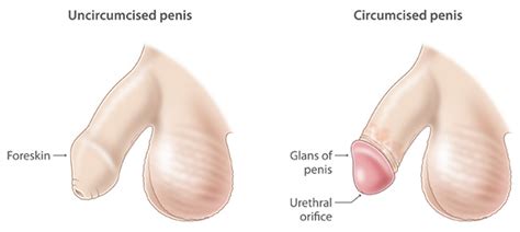 Poor circulatory health is definitively linked with erectile dysfunction because you can't rack up wood if you can't get blood to rush into the penis. Circumcision - For Baby, Newborns & Adults - Pros & Cons ...