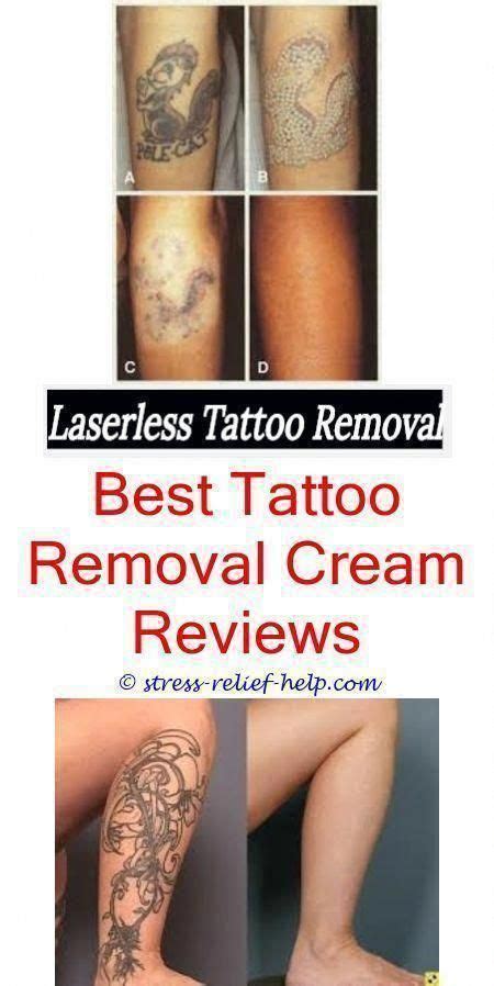 These are much more natural remedies, but focus on gradually lightening of the whole area of skin and take a long time to show results. custom tattoo big tattoo removal before and after - how to ...