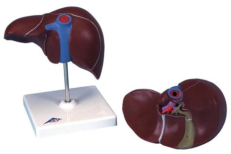 Sometimes the gallbladder fails to work properly, and can become filled with gallstones. 3B Scientific K25 Liver with Gall Bladder Model