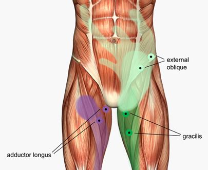 The muscles of the pelvis, hip and buttock anatomical chart shows how each muscle in this area of the body works with the others, and the various minor systems within the major ones. The Latest Trend In Painful Muscle Spasms In Groin ...