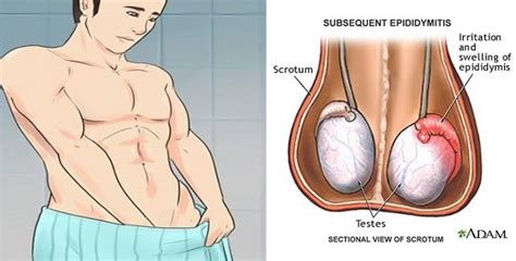 There may be no real pain, at most just a dull ache in the lower abdomen or groin, perhaps a sensation of dragging and heaviness. Mesmerizing words: 5 Signs Of Testicular Cancer Most Men ...