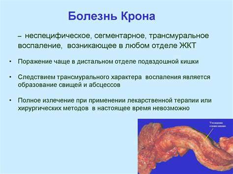 Болезнь крона диета при ремиссии