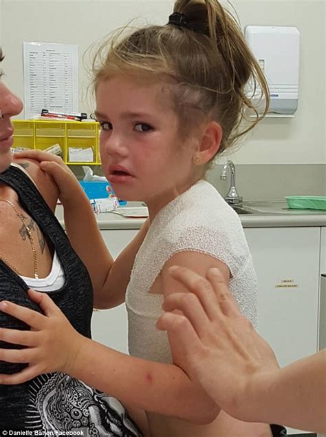 Unlike the daughter of an attuned mother who grows in reflected light, the unloved daughter is diminished by the connection. Adelaide pair left with burns despite using Cancer Council ...