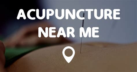 You can see reviews of companies by clicking on them. ACUPUNCTURE NEAR ME - Points Near Me