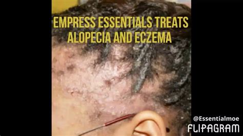 See full list on wikihow.com GROW YOUR EDGES BACK FAST! - YouTube