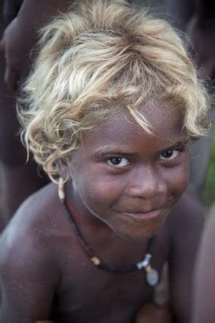 Blacks and blondes 37 (video 1986). Debunking another "We are not Albinos" study