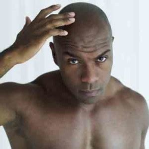 There are many different causes of alopecia, some permanent, others temporary. Ostarine Hair Loss - Dan the Bodybuilder in Thailand