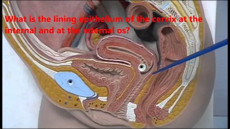 However, one week later, the woman began to suspect that her injury was more serious than it appeared. Anatomy of female genital organs - plastic models - YouTube