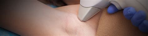 Burns, permanent changes to your skin color, and scars can occur. Permanent Laser Hair Removal - DR CRB Aesthetic & Laser Clinic