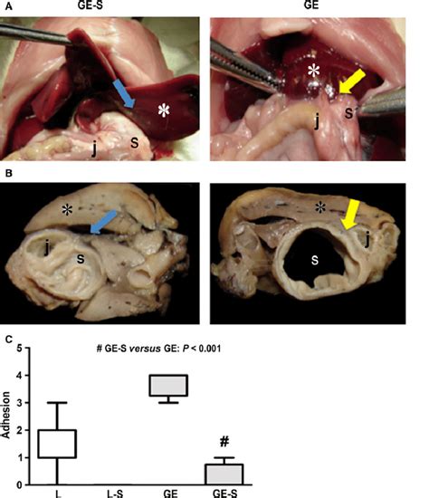 Glands in your stomach lining make stomach acid and enzymes that break down food. Laparotomy view showing crosssections of fresh liver (*), stomach (s)... | Download Scientific ...