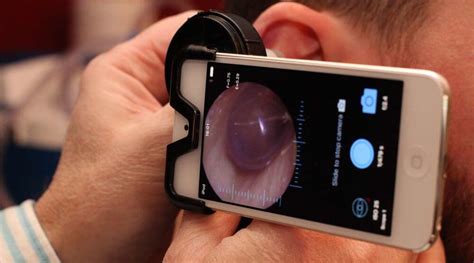 See your doctor if nothing works. Endoscopic Microsuction - The Ear Wax Removal Specialists UK