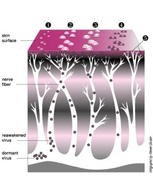 Was diegnosed with rectal herpes but there is more going on than that. The Stages of Herpes: Understand the Herpes Virus Better!