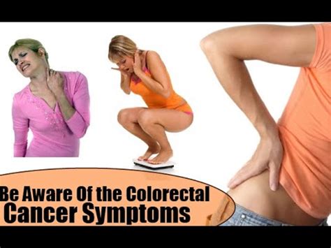 Also, they differ in severity based on the location of cancer in the colon, growth, and size. Colon Cancer | Colon Cancer Symptoms and Signs - YouTube