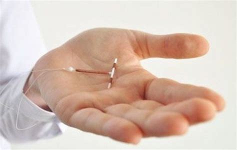 Farmini diese variante nicht an. Biaya Pasang IUD (KB Spiral) Terupdate Terbaru | Biaya.Info