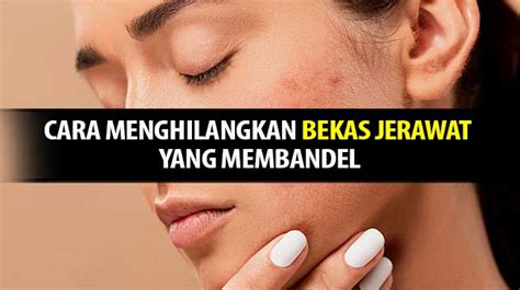 Pertama yang kita bahas adalah cara menghilangkan jerawat dengan herbal / bahan yang ada disekitar kita. Cara Menghilangkan Bekas Jerawat Yang Efektif Dengan Cara ...