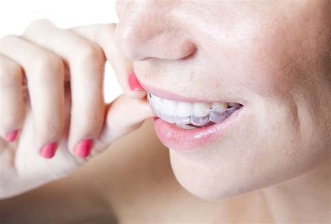 How to properly clean invisalign retainers. How to Clean and Care for Invisalign Retainers