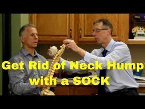 I've had this hump on the back of my neck since i was about 8 or 9 year's old. How You Can Get Rid of Neck Hump With a SOCK. Dowager's ...