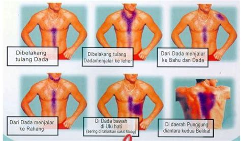 Maybe you would like to learn more about one of these? Tanda-tanda Awal Jantung Bermasalah! - Kerabu Bersuara